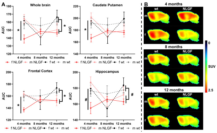 A) AUCs of [18F]FMPEP-d2 TACs for AppNL-G-F and wt mice (m/f) at 4-, 8- and 12-months, for whole brain, caudate putamen, frontal cortex and hippocampus. Mean±SEM, *P < 0.05 and #P < 0.10 for genotype comparisons. B) Average summed (0-120 min) images of [18F]FMPEP-d2 in brain of wt and AppNL-G-F mice of both sexes (m/f) at 4-, 8- and 12-months of age. Shown are sagittal images at the right side of brain (2 mm from middle line). Abbreviations: AUC: area under the curve; m/f: male, female; NLGF: AppNL-G-F; SUV: standardized uptake value; TAC: time activity curve; wt: wild-type.