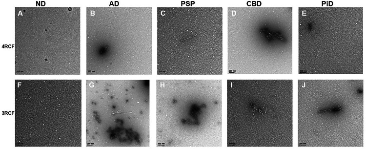 Transmission electron microscopy of SAA end products of skin misfolded tau from AD, other tauopathies and normal controls.Panels (A) through (E) show the representative images of tau 4RCF-based RT-QuIC with normal controls (NC, A), AD (B), PSP (C), CBD (D) and PiD (E). Panels (F) through (J) exhibit the representative images of tau 3RCF-based RT-QuIC with normal controls (NC, F), AD (G), PSP (H), CBD (I) and PiD (J). Scale bars: 200 nm.