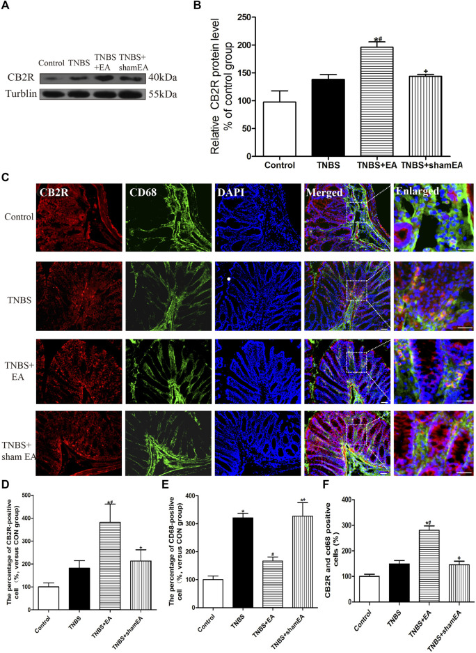 EA increased CB2 receptor activation in macrophages in the colon tissues. (A) Representative western blot images show the protein level of CB2 receptors in the colon tissues. (B) Summary data show the relative protein level of CB2 receptors in the colon tissues. (C) Representative images of immunofluorescence staining using DAPI (blue), anti-CD68 antibody (macrophages) (green) and CB2 receptor antibody (red) in the colon tissues. Summary of the number of CB2 receptor- (D) and CD68− (E) positive cells per observation field. (F) Summary data show the percentage of double-labeled cells in the colon tissues. Data are expressed as mean ± SEM (n = 6 per group). Merged, scale bar, 50 μm; Enlarged, scale bar, 50 μm *p < 0.05 versus with Control group, #p < 0.05 versus with TNBS group, +p < 0.05 versus with TNBS + EA group.