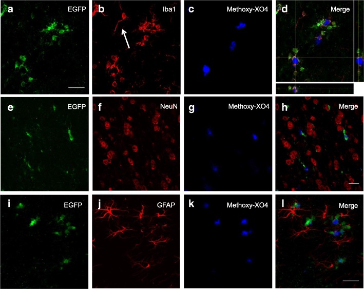 EGFP expression is limited to plaque-associated microglial cells but is absent in neurons and astrocytes in CB2EGFP/f/f/5xFAD mice. a–c Z-stack showing that EGFP expression (a) was evident in microglial cells (b) located in close association to amyloid-enriched neuritic plaques, as revealed by methoxy-XO4 (c). However, microglial cells not linked with these pathological structures (arrow in b) showed reduced EGFP signal. d Orthogonal view in Z axis of the cluster of microglial EGFP+ cells shown in (a–c). Note the intimate contact established by microglial processes into the neuritic plaque. e–l Neurons (NeuN+ cells; e–h) nor astrocytes (GFAP+ cells; i–l) showed no EGFP signal. Scale bars, 25 μm