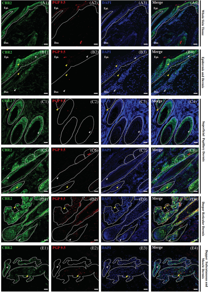 Triple confocal microscopic in‐situ expression of CBR2 (green), PGP 9.5 (red) and DAPI (blue) in the whole‐skin tissue under 20x magnification; scale bars = 50 μm (A1‐A4). Below, a set of images presenting the layers of the equine skin, with emphasis on their respective epidermal and dermal compartments. Epidermis (Epi.: stratum basale, granulosum, spinosum and corneum; B1‐B2) and dermis (B1‐B2) and dermis (Der.: upper and lower superficial papillary dermis—C1‐C8, deeper reticular dermis—D1‐D4, and deep subcutaneous and muscle dermis—E1‐E4) with their respective compartments. The specific region of interest (white dotted lines) and randomly selected example regions with single CBR2 (gray arrows) and double positive in co‐localization with PGP 9.5 (yellow arrows) specific immunoreactivity are indicated. Images were taken under 40x magnification, scale bars = 20 μm