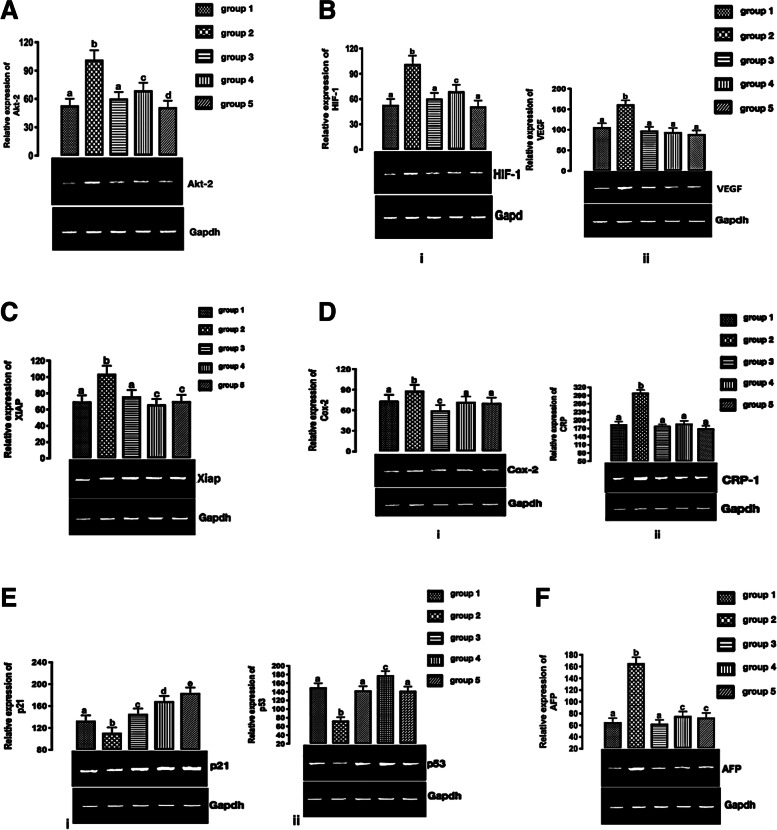 A Expression of Akt-2 mRNA in HCC. Different letters on the bars show significant different. Significance is at p < 0.05. B (i) HIF-1 and (ii) VEGF mRNAs expression in HCC. Different letters on the bars show significant different. Significance is at p < 0.05. C Expression of XIAP mRNA in HCC. Different letters on the bars show significant different. Significance is at p < 0.05. D COX-2 and (ii) CRP mRNAs expression in HCC. Different letters on the bars show significant different. E (i) p21 and (ii) p53 mRNAs expression. Different letters on the bars show significant different. Significance is at p < 0.05. F AFP mRNA expression. Different letters on the bars show significant different. Significance is at p < 0.05