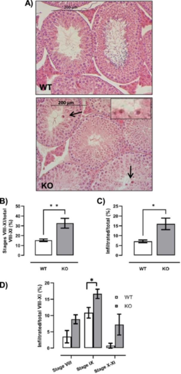 Histological analysis of seminiferous tubules from WT and CB1−/− (KO) testes. H&E staining of WT and CB1−/− (KO) testes: inset shows infiltrated blood cells (scale bar: 200 μm; inset scale bar: 10 μm) (A). Number of Stages VIII, IX and X–XI relatively to total tubules (B). Number of infiltrated tubules relatively to total tubules (C). Infiltrated tubules at Stages VIII, IX and X–XI relatively to the infiltration window (tubules at Stages VIII–XI) (D). All the data were reported as mean values ± S.E.M. (*p < 0.05; **p < 0.01).