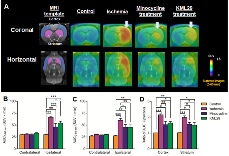 PET imaging for TSPO in the brain of MCAO rats with or without medication treatment. PET images were summed between 0 and 60 minutes after injection of [18F]FEBMP and are shown as coronal and horizontal slices for healthy control, ischemia, minocycline-treated, and KML29-treated rats. The AUC0-60 min values in regions of interests (cortex: B; striatum: C) were calculated from time-activity curves of the contralateral and ipsilateral sides in each rat. The ratio of AUC0-60 min was calculated by dividing the AUC0-60 min value of the ipsilateral side by the AUC0-60 min of the contralateral side in each region of interest (D). Radioactivity in PET images is expressed as SUV. Values are presented are presented as the mean ± SEM. *P < 0.05, **P < 0.01, and ***P < 0.001.