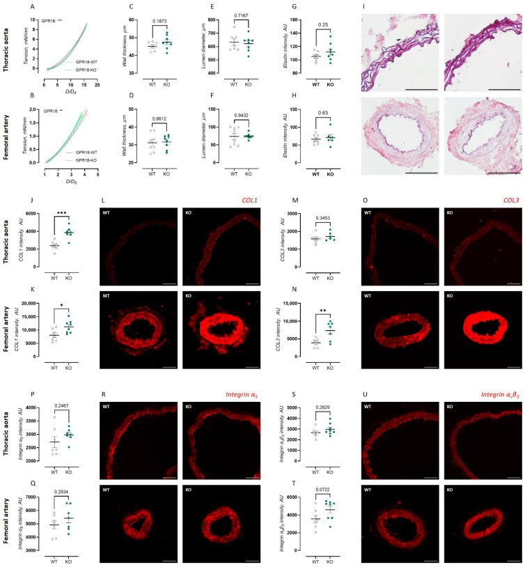 Biomechanical properties and wall composition of the thoracic aorta and femoral artery of GPR18 KO mice. Passive arterial wall distensibility was assessed as the stress–tension relationship, with D/D0 representing relative diameter change, in Krebs–Ringer solution of the thoracic aorta (WT, n = 9; KO, n = 9) (A) and femoral artery (WT, n = 8; KO, n = 10) (B). Vessel dimensions, i.e., wall thickness (C,D) and lumen diameter (E,F), were measured by delineating the internal and external elastic laminae using the autofluorescent signal of elastin in the thoracic aorta (C,E) and femoral artery (D,F). Quantification of orcein staining intensity (G,H) and immunofluorescent intensity for collagen type 1 (J,K), collagen type 3 (M,N), integrin α5 (P,Q), and integrin αvβ3 (S,T) in the thoracic aorta (G,J,M,P,S) and femoral artery (H,K,N,Q,T). Representative images of orcein staining (I) and immunofluorescent staining for collagen type 1 (L), collagen type 3 (O), integrin α5 (R), and integrin αvβ3 (U) in the thoracic aorta (upper panel) and femoral artery (lower panel) of GPR18 WT and KO mice. Scale bars represent 100 µm (thoracic aorta immunofluorescence) or 50 µm (femoral artery, thoracic aorta orcein). Data are expressed as quadric regression curve ± 95% CI (A,B) or mean ± SEM (C–T). Statistical analysis using sum-of-squares F-test (A,B) or Student’s t-test (C–T). * p < 0.05; ** p < 0.01; *** p < 0.001.