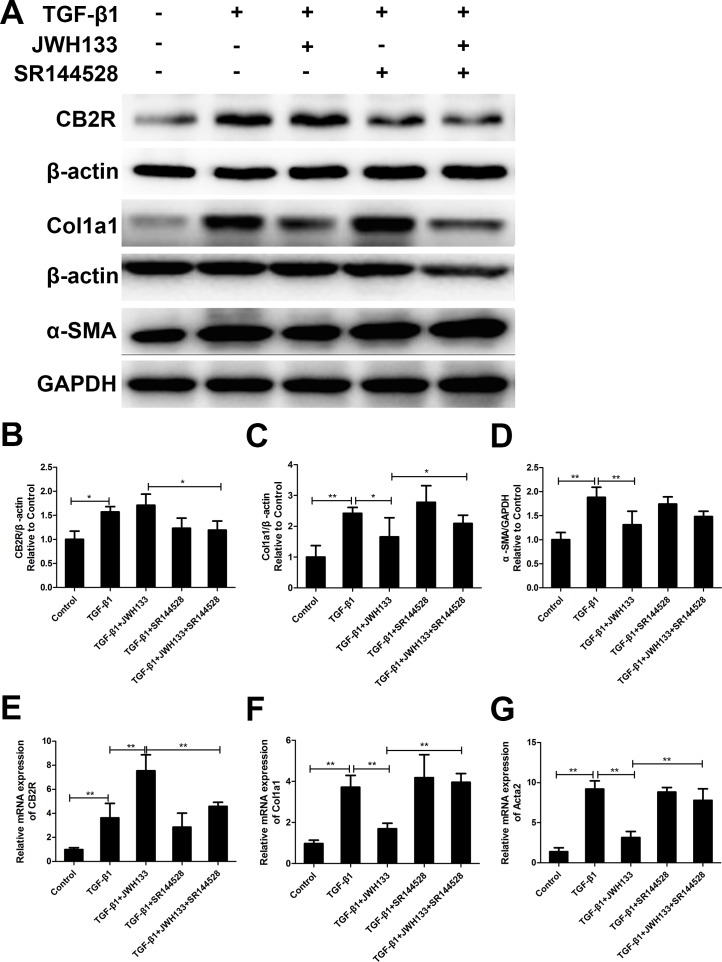 CB2R agonist JWH133 inhibited TGF-β1 induced mice lung fibroblasts collagen I and α-SMA expressionMice lung fibroblasts were preincubated (30 min, 37°C) with or without JWH133 (10μM) or/and SR144528 (1.0μM), then stimulated (48 h, 37°C) with TGF-β1 (5ng/ml). The expression of cannabinoid receptor type 2 (CB2R), collagen I (Col1a1) and α-SMA (Acta2) were evaluated by western blotting (A) and RT-qPCR (E, F and G); (B, C and D): quantification of CB2R, Col1a1 and Acta2. Data are mean ± SD of 3 independent experiments. *P < 0.05, **P < 0.01.