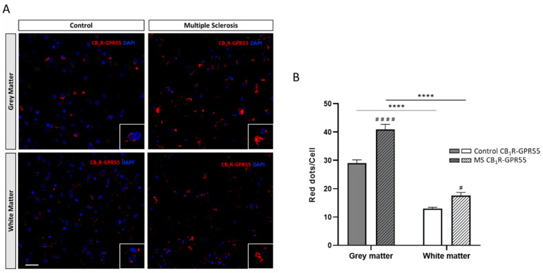 CB1R-GPR55 heteromers detected using the In Situ Proximity Ligation Assay (PLA) in the grey (GM) and white matter (WM) of the prefrontal cortex of samples from the controls and multiple sclerosis (MS) patients. Representative confocal images (40×) showing PLA label for CB1R-GPR55 heteromers as red dots in cells with DAPI-stained nuclei. Scale bar 50 µm (A). Quantification of CB1R-GPR55 heteromers as the number of red dots per cell in the GM and WM in the prefrontal cortex samples of the controls and MS patients. Data are the mean ± SEM (40 fields per section) (B). Significant differences were analyzed via two-way ANOVA followed by post hoc Bonferroni’s test. **** p < 0.0001 compared with GM; # p < 0.05, #### p < 0.0001 compared with the control.