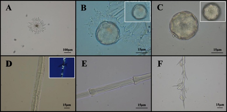 Other micro-remains at light microscopy. Representative images of micro-debris found in dental calculus samples: peltate trichome of Olea sp. (a); Hedera pollen grain (b); Juglans regia pollen grain (c); plant fiber and relative polarized image (d); fragment of feather barbule typical of Anseriformes (e); bee hair (f)