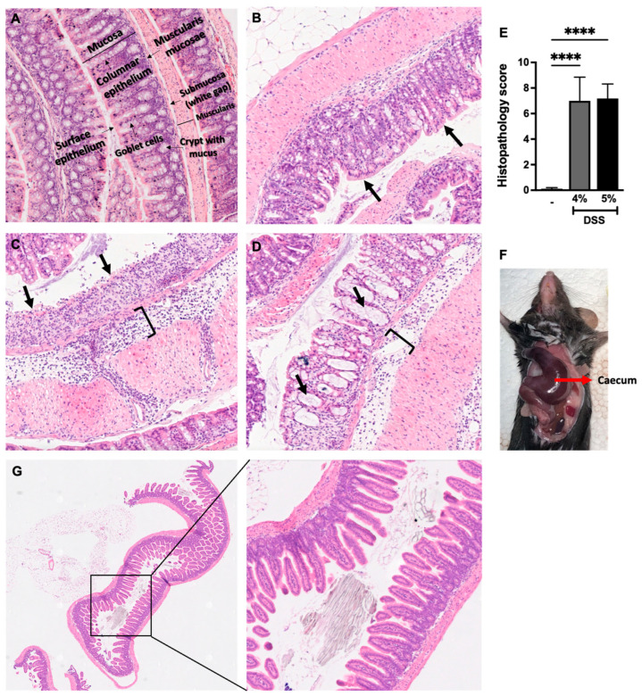 DSS administration induces histological alterations in mouse colons: Hematoxyline and eosin staining of colon tissues of mice given either water or DSS 4% or DSS 5%. (A) Well-defined intact layers of colon tissue from mice given water. Mice being given DSS 4% or DSS 5% causes histological alteration in colon tissue including (B) inflammatory cell infiltration with intact or undamaged surface epithelium (black arrow indicates intact surface epithelial layer); (C) inflammatory cell infiltration from mucosa to muscularis, surface epithelial erosion, and loss of crypts (black arrow indicates erosion of epithelial layer); and (D) crypts filled with mucus. The bracket “]” indicates the oedema in submucosa leading to the increase in the thickness of the colon tissue. (E) Histopathological score of colon tissues of mice given either water, DSS 4%, or DSS 5%. (F) A picture of a dissected mouse (administered DSS 5%) showing enlarged and discolored caecum. (G) Hematoxyline and eosin staining of small intestine in mice administered DSS 4%. Data are represented as means ± SEMs; N = 8–10 (water and DSS 4%) and 5 (DSS 5%). White bar indicates mice given water only. **** p < 0.0001 using one-way ANOVA with a post hoc analysis.