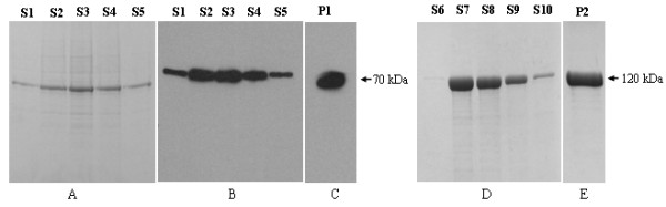 (A) Coomassie staining of purified HIS-FAAH recombinant protein from Dictyostelium. Dictyostelium cells AX3FAAH expressing HIS-FAAH were lysed and the recombinant protein was bound to Ni-NTA resin. Resin bound protein was eluted using lysis buffer containing 200 mM Imidazole and the eluate fractions S1, S2, S3, S4, S5 were resolved on 10% SDS-PAGE and Coomassie stained. (B) Western blotting analysis. Fractions analysed in Figure 2A were analysed by Western blotting using anti-HIS antibody. (C) Western blotting analysis. Fractions analysed in Figure 2A/2B were pooled together (P1) and analysed by Western blotting using anti-FAAH polyclonal antibody and the same fraction was used in enzyme kinetic assay. (D) Coomassie staining analysis of purified recombinant MBP-FAAH protein from E.coli. Cells expressing recombinant MBP-FAAH were lysed and the recombinant protein was bound to amylose resin. Resin bound recombinant protein was eluted using lysis buffer containing 15 mM maltose and the eluate fractions S6, S7, S8, S9, S10 were resolved on 10% SDS-PAGE and Coomassie stained. (E) Coomassie staining analysis. Fractions analysed in Figure 2D were pooled together (P2) and analysed by Coomassie staining.
