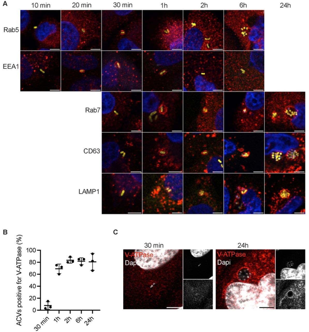 Intracellular trafficking of A. bacteriaumannii ABC141 ACVs.(A) Representative confocal immunofluorescence microscopy images of Rab5, EEA1, Lamp1, CD63 and Rab7 (red) recruted or not to the ABC141 (yellow) ACVs in EA.hy926 endothelial cells at 10, 20, 30 min or 1, 2, 6 and 24h. Dapi was used to visualize nuclei and bacteria. (B) Quantification of the percentage of ACVs positive for V-ATPase at different time points after infection. Data correspond to the means ± SD of 3 independent experiments. (C) Representative images of V-ATPase positive (red) ABC141 (white) ACVs at 30 min (left) and 24h post-infection (right). Dapi was used to visualize nuclei and bacteria. All scale bars correspond to 5 μm