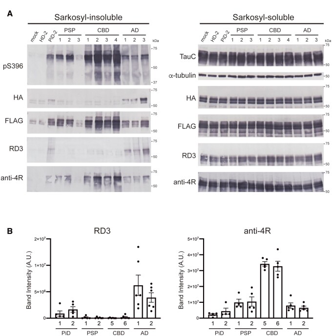 Seeded tau aggregation induced by patient-derived tau strains in SH-SY5Y cells co-expressing 3R tau and 4R tau. (A) Sarkosyl-insoluble fractions extracted from patients’ brains (1 μl) were introduced into SH-SY5Y cells transiently co-expressing HA-tagged human tau 3R1N and FLAG-tagged human tau 4R1N. Immunoblot analysis of sarkosyl-insoluble fractions (left) and sarkosyl-soluble fractions (right) extracted from mock-transfected cells, and cells with introduced sarkosyl-insoluble fractions from a Huntington’s disease case, a PiD case, three PSP cases, four CBD cases and three Alzheimer’s disease cases. Insoluble tau was detected with pS396, anti-HA, anti-FLAG, RD3 and anti-4R antibodies. Total tau was detected with TauC, anti-HA, anti-FLAG, RD3 and anti-4R antibodies. The tau concentrations of pathogenic tau seeds derived from human brains are shown in Supplementary Table 2. Full-length blots are presented in the Supplementary material. (B) Quantification of insoluble tau accumulated in transfected SH-SY5Y cells co-expressing human tau 3R1N and 4R1N with patient-derived tau seeds. The band intensities of the immunoblots with RD3 (left) and anti-4R (right) antibodies shown in Supplementary Fig. 5 were evaluated. The results are expressed as means ± SEM (n = 4–6).