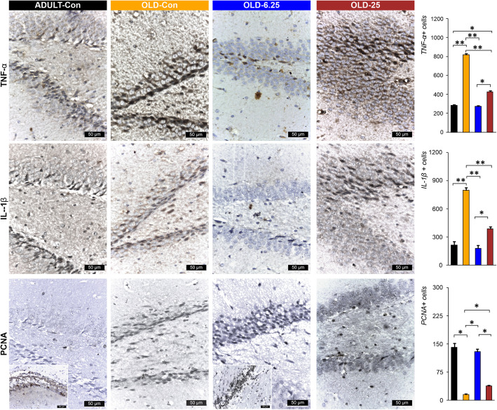 Representative images of the Cannabixir® therapy effect on the expression of PCNA, IL-1β and TNF-α. The results reveal heightened IL-1β and TNF-α levels alongside reduced PCNA expression in the hippocampal regions of the OLD-Con group, underscoring an amplified inflammatory response associated with aging. Conversely, the ADULT-Con and OLD-6.25 groups display lower IL-1β and TNF-α levels and increased PCNA expression, suggesting a potential protective influence of treatment against age-related inflammation. PCNA-positive nuclei were fewer in the OLD-Con group, moderately distributed in the OLD-25 group, and most abundant in periventricular areas of the OLD-6.25 and ADULT-Con groups. Parameter and treatment group abbreviations: PCNA: Polyclonal Antibody: proliferating cell nuclear antigen polyclonal antibody; IL-1β: interleukin-1 beta; TNF-α: tumor necrosis factor-alpha; OLD-Con: the naturally aged control group; OLD-6.25: the Cannabixir® Medium Flos 6.25 mg/kg naturally aged group; and OLD-25: the Cannabixir® Medium Flos 25 mg/kg naturally aged group; ADULT-Con: the young adult control group. PCNA positive cells quantification in the hippocampal dentate gyrus in different groups. The bars indicate the mean ± SEM. Student t -test: * p < 0.05. IL-1β and TNF-α positive cells quantification in the hippocampal dentate gyrus
