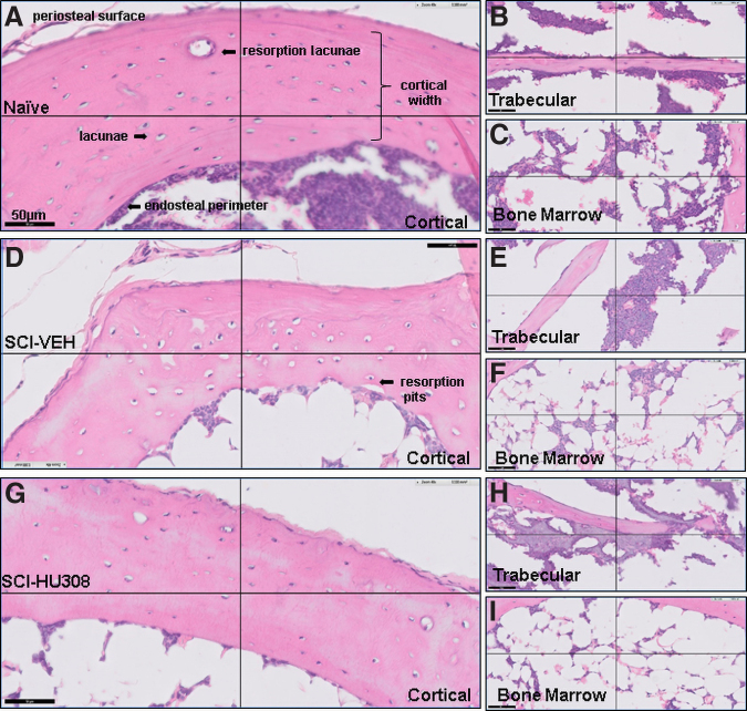 Histological staining of decalcified proximal tibiae from mice evaluated after 40 days of acute treatment. Photomicrograph of H&E staining of cortical bone in (A) naïve, (D) SCI-VEH, and (G) SCI-HU308 animals. Photomicrograph of H&E staining of trabecular bone in (B) naïve, (E) SCI-VEH, and (H) SCI-HU308 animals. Photomicrograph of H&E staining of bone marrow in (C) naïve, (F) SCI-VEH, and (I) SCI-HU308 animals. Images obtained using a Philips Slide Digitizer. Bar represents 50 μm. Periosteal surface and resorption pits in cortical region are labeled. H&E, hematoxylin and eosin; SCI, spinal cord injury; VEH, in vehicle.