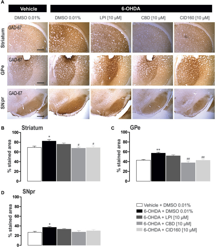 The intrapallidal injection of CBD or CID16020046 decreases the immunoreactivity of GAD-67 in the GPe and striatum of rats with 6-OHDA-induced injury. (A) shows the immunoreactivity of GAD-67 in the striatum, GPe, and SNpr. Photomicrographs were taken at 40x, while the scale bar represents 500 µm. Graph (B) shows the proportion of the area stained for TH in the striatum, while (C,D) show the percentage area stained for TH in the GPe and SNpr, respectively. The results obtained show that GAD-67 expression increased in the ipsilateral striatum, GPe, and SNpr of the 6-OHDA + DMSO group in contrast with the control group. However, a decreased level of GAD-67 immunoreactivity was only observed in the nuclei of the striatum and GPe ipsilateral to the lesion in 6-OHDA + CBD and 6-OHDA + CID160 groups. The values show mean ± SEM (n = 4 per group). Statistics were determined with a one-way ANOVA and a Tukey post-hoc test. * p < 0.05, ** p < 0.01 vs. vehicle group. # p < 0.05, ## p < 0.01 vs. 6-OHDA + DMSO group.