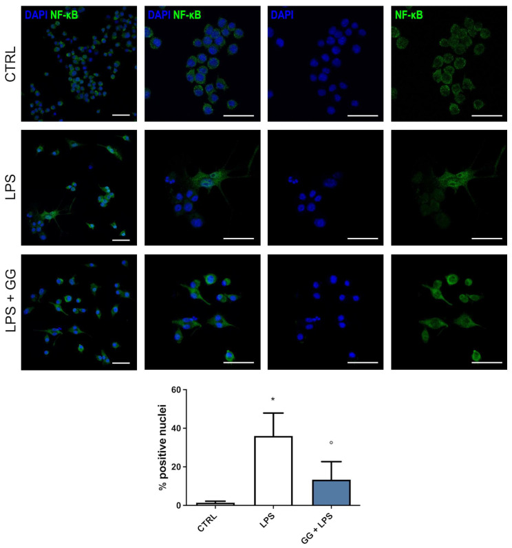 GG EO prevents NF-κB nuclear translocation. BV-2 cells were pretreated with 5 × 10−3 µL/mL Gorilla Glue (GG) EOs for 2 h and then exposed to 100 ng/mL LPS for a further 24 h. Cells were immunostained with a primary antibody against NF-κB, followed by a secondary Alexa Fluor 488-antibody (green), and cell nuclei (blue) were visualized with DAPI. Magnification images are shown both as single signals and as a merger. Scale bar = 50 µm. The graph shows the percentage of nuclei positive for NF-κB evaluated in five fields (around 100 cells) for each condition. * p < 0.05 vs. CTRL; ° p < 0.05 vs. LPS.