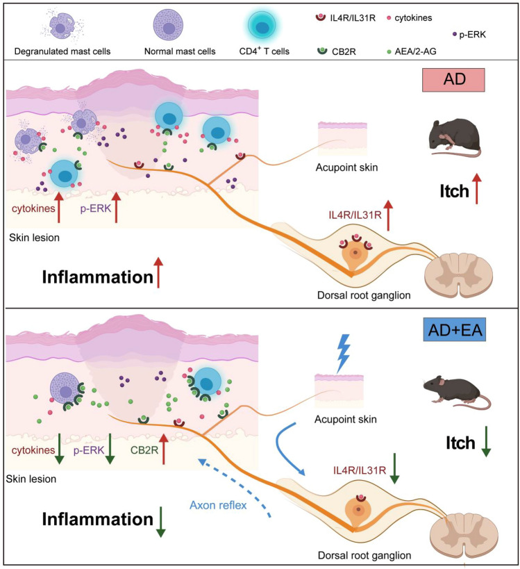 Schematic diagram of this study's findings on the impact of EA on AD Mice. This schematic diagram presents the pathophysiological alterations in AD and the therapeutic interventions of EA treatment. Initially, upon the induction of AD, there is an escalation in the number of mast cells and CD4+ T cells within the skin lesions, along with upregulation of cytokines IL4, IL13, and IL31, and their receptors IL4R and IL31R in the cervical DRG. These changes are linked to the exacerbation of chronic itching and skin inflammation. Despite an upregulation of the CB2R, the endogenous levels are not adequate to effectively inhibit ERK phosphorylation, a key driver of inflammatory processes (left side). In contrast, EA treatment, applied via specific acupoints corresponding to the affected dermatome, initiates a cascade of anti-inflammatory effects. EA stimulates axon reflexes that enhance the synthesis of endocannabinoids and reduce their degradation in the lesional skin tissue. This results in elevated levels of the primary endocannabinoids such as AEA and 2-AG, which in turn upregulate the expression of CB2R. Stimulation of CB2R by endocannabinoids leads to a significant reduction in ERK hyperphosphorylation, an essential process in curbing inflammatory response. As a result, EA treatment diminishes the number of mast cells and CD4+ T cells in lesional skin, reduces the expression of pro-inflammatory cytokines IL4, IL13, and IL31, and decreases the expression of IL4R and IL31R in the cervical DRG. Collectively, these effects contribute to the alleviation of itching and the inhibition of inflammation development (right side)
