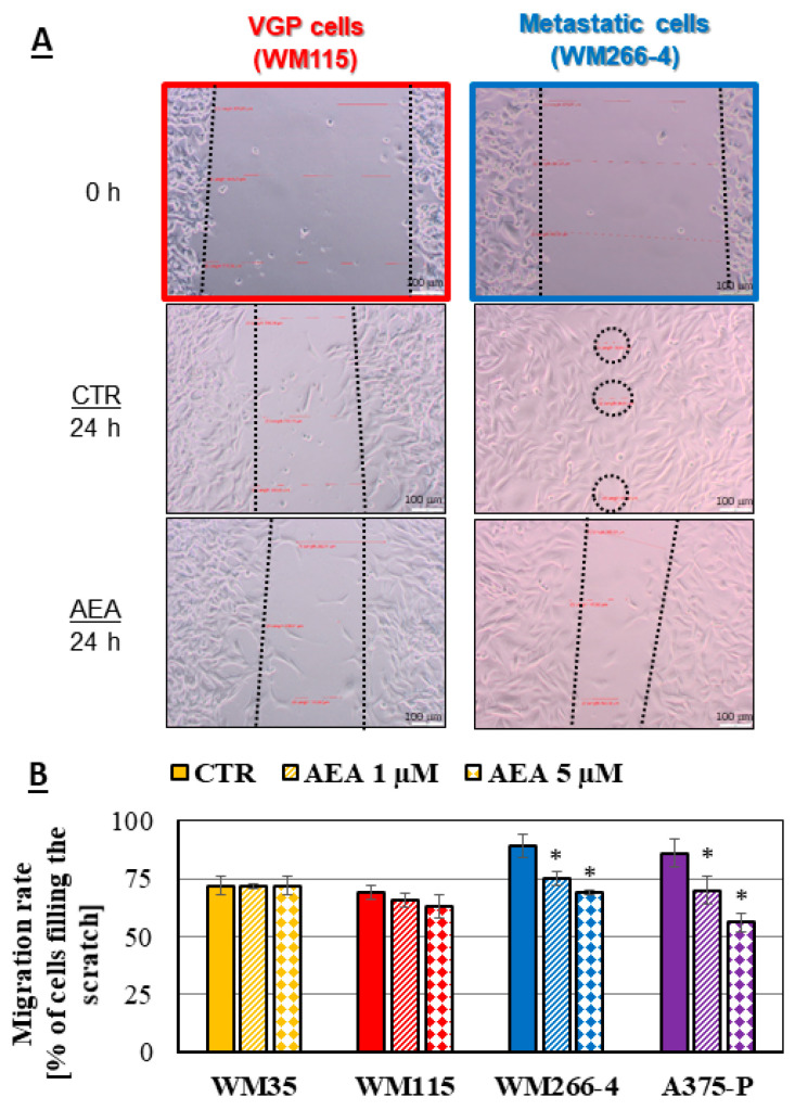 Migration rate analysis of melanoma cells: (A)—the representative pictures of the closely related WM115 and WM266-4 melanoma cells (from the same patient) after creating the scratch (0 h) and 24 h later after the 1 μM AEA treatment (scale bar—100 μm). (B)—the calculated migration rate of different melanoma cells after 1 μM and 5 μM AEA treatment. The statistical significance of the p-value below 0.05 (*) was marked on the graph.