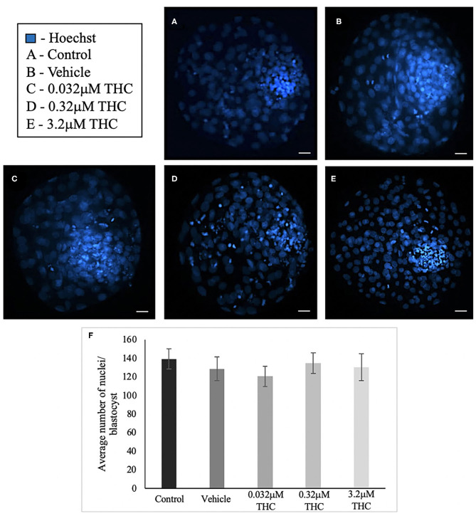 Total nuclei count in blastocysts produced from THC treated oocytes. (A) Control blastocyst. (B) Vehicle blastocyst. (C) Low (THC) (0.032 μM) blastocyst. (D) Mid (THC) (0.32 μM) blastocyst. (E) High (THC) (3.2 μM) blastocyst. (F) Total cell number. Oocytes were matured in doses of THC correlating to therapeutic cannabis use [low (THC)] and recreational cannabis use [mid (THC), high (THC)] as well as vehicle and control groups, followed by fertilization and culture to the blastocyst stage. Blastocysts were collected at 8 days post-fertilization and stained using either the differential staining or TUNEL protocol. Blastocysts were imaged with a Leica CTR5500B fluorescent microscope at the 20 × objective. Cells were counted manually and verified using ImageJ software. Each group had 25–34 biological replicates (blastocysts) analyzed. Bars represent the mean ± SEM. Scale bar =100 μm.