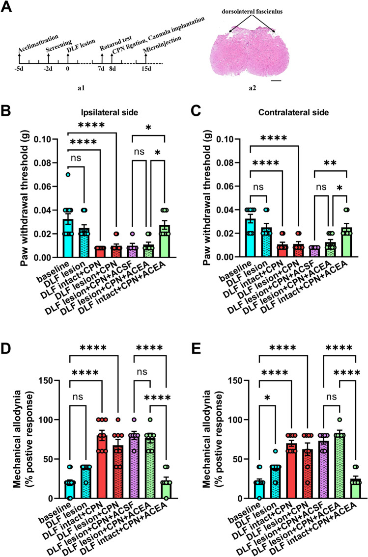 DLF lesion abolishes the analgesic effect of CB1R activation in the RAIC following CPN ligation. A According to the time course (a1), the bilateral DLF is damaged in wild mice (a2). Scale bar, 50 μm. Effects of a DLF lesion on both sides. The physical sensations of pain, neuropathic pain formation, and ACEA-mediated analgesia are tested by mechanical hyperalgesia (B, C) and allodynia (D, E). B, C DLF lesion does not affect the bilateral PWTs of WT mice (baseline vs DLF lesion). With or without a DLF lesion, the bilateral PWTs of WT mice decrease significantly after CPN ligation (baseline vs DLF intact+CPN and vs DLF lesion+CPN). The pain inhibitory effect of ACEA on mechanical hyperalgesia in CPN-ligated mice is blocked after a bilateral DLF lesion (DLF lesion+CPN+ACEA vs DLF intact+CPN+ACEA). D, E The mechanical allodynia of the contralateral but not the ipsilateral side increases significantly (baseline vs DLF lesion). Compared to the baseline, the mechanical allodynia increases significantly after CPN ligation (baseline vs DLF intact+CPN and vs DLF lesion+CPN). The analgesic effect of ACEA on mechanical allodynia is inhibited after a bilateral DLF lesion (DLF lesion+CPN+ACEA vs DLF intact+CPN+ACEA). Baseline, 12 mice; DLF lesion group, 12 mice; DLF intact+CPN group, 9 mice; DLF lesion+CPN group, 12 mice; DLF lesion+CPN+ACSF group, 6 mice; DLF lesion+CPN+ACEA group, 8 mice; DLF intact+CPN+ACEA group, 8 mice. *P <0.05, **P <0.01, ***P <0.001, ****P <0.0001; one-way ANOVA.