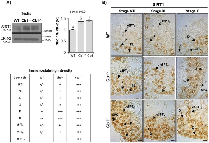 A composite image showing protein analysis and immunostaining in testis. A) On the left, a Western blot for SIRT1 and ERK-2 in WT, Cb1+/-, and Cb1-/- testis, with a graph indicating increased SIRT1/ERK-2 ratio in mutants. An immunostaining intensity table follows. B) Microscopic images display SIRT1 localization in testis at different stages (VIII, XI, X) across WT, Cb1+/-, and Cb1-/- samples, with varying staining intensities marked by arrows indicating specific germ cell types.