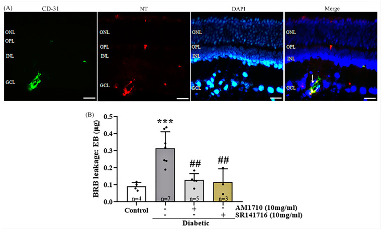 Effect of cannabinoid treatment on diabetes-induced blood–retinal barrier leakage. (A) Co-localization of CD-31, NT, and the nuclear marker DAPI. Representative photomicrograph of a diabetic untreated retina, showing that NT is colocalized with CD-31 in blood vessels in the GCL. White arrow marks the co-localization area. Magnification: 20×. Scalebar: 50 μm. (B) Quantitative analysis of EB data: Diabetes induced an increase in BRB leakage (*** p = 0.0007 compared to Control). Treatment with either AM1710 (## p = 0.0021 compared to diabetic untreated, p > 0.05 compared to Control) or SR141716 (## p = 0.0048 compared to diabetic untreated, p > 0.05 compared to Control) blocked this effect. Data are expressed as mean ± S.D and presented in a form that combines a bar diagram and scatter dot plot, with every dot representing a different value. One-way ANOVA was employed for the statistical analysis of all data, followed by Tukey’s multiple comparison test. Differences were considered statistically significant when p < 0.05.