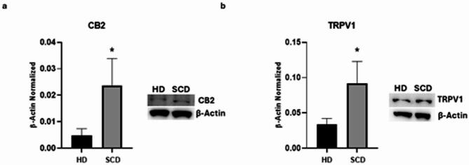 CB2 and TRPV1 expression in SCD macrophages obtained from SCD pediatric/young patients. CB2 (a), TRPV1 (b) protein expression levels in sickle cell disease (SCD) macrophages compared to those of healthy donors (HD), evaluated by Western blotting starting from 15 µg of total lysates. The most representative images are displayed. The protein bands were detected through Image Lab Ink 6.1 software “BIORAD”, and the intensity ratios of immunoblots compared to HD, taken as 1, were quantified after normalizing with the respective controls. The relative quantification for these proteins, normalized for the housekeeping protein β-actin, is represented in the histograms as the mean ± SD. An unpaired t-test was performed for statistical analysis. *, p ≤ 0.05 compared to HD. Original blots/gels are presented in Supplementary Uncropped WB Figures.