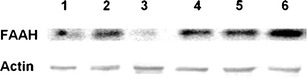 Western blots for fatty acid amide hydrolase (FAAH) protein in endothelium-intact human pulmonary arteries (lanes 1–3) and lungs (lanes 4–6). Samples used for electrophoresis consisted of 100 μg of protein of pooled tissue extracts (n = 6) obtained from three different experiments. The selectivity of the FAAH antibody was proved previously by Fowler et al. (2001). β-actin (43 kDa) was used as a loading control
