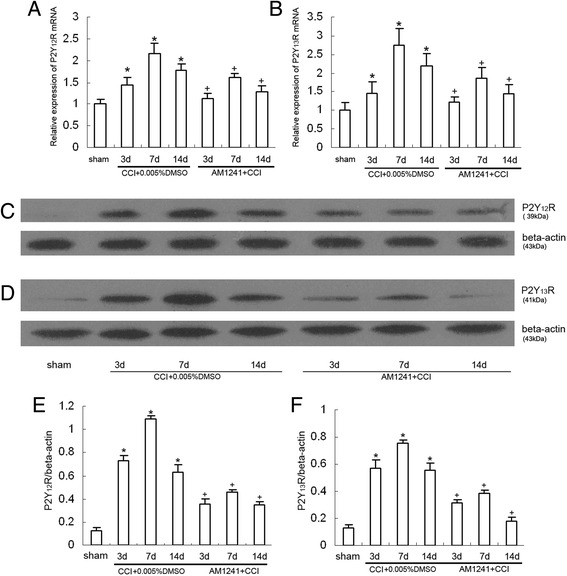 Intrathecal injection of AM1241 (100pM) attenuated CCI-induced hyperalgesia and increased expression of P2Y12 and P2Y13R in the rat dorsal spinal cord. a RT-PCR quantitative analysis of the P2Y12R mRNA expression. *P < 0.05 means comparison with the sham group; + P < 0.05 means comparison with the vehicle-treated CCI group. n = 8 per group. b RT-PCR quantitative analysis of the P2Y13R mRNA expression. *P < 0.05 means comparison with the sham group; + P < 0.05 means comparison with the vehicle-treated CCI group. n = 8 per group. c Western blotting image of P2Y12R expression. The top panel was the target band, P2Y12R protein, and the bottom one was for the loading control beta-actin. d Western blotting image of P2Y13R expression. The top panel was the target band, P2Y13R protein, and the bottom one was for the loading control beta-actin. e Western blotting quantitative analysis of the P2Y12R expression. *P < 0.05 means comparison with the sham group; + P < 0.05 means comparison with the vehicle-treated CCI group. n = 8 per group. f Western blotting quantitative analysis of the P2Y13R expression. *P < 0.05 means comparison with the sham group; + P < 0.05 means comparison with the vehicle-treated CCI group. n = 8 per group