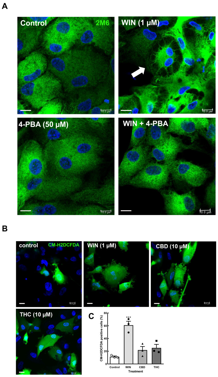 4-Phenyl-butyrate inhibits intracellular vacuolization in cultures treated with WIN 4-phenyl-butyrate (A). Glia-enriched cultures on coverslips at E8C13 were incubated with 1 µM WIN or with WIN plus 50 µM 4-PBA for 24 h, and then were fixed and processed by imunnocytochemistry for the avian glial-specific antigen 2M6. Hoechst was used to stain cell nuclei (blue). Cultures were visualized and photographed on a Leica SP5 confocal microscope. Note the large vacuoles in the WIN-treated cultures (arrows). Imunnofluorescence assays were conducted 3 times, with similar results. CM-H2DCFDA oxidation assays in retinal cultures (B,C). Glia-enriched cell cultures on coverslips at E8C10–E8C12 were treated with 1 µM WIN, 10 µM CBD, or 10 µM THC for 3 h, and then washed and incubated with the CM-H2DCFDA probe. Ten fields along the diameter of the coverslip were immediately photographed on a Leica SP5 microscope using a 40× objective and 405 and 488 laser lines following the manufacturer’s instructions. Hoechst was used to label cell nuclei (blue) and estimate the total number of cells in each field. The number of CM-H2DCFDA-labeled cells was divided by the number of cell nuclei in each field and expressed as the percentage of labeled cells (C). From 750 to 1030 nuclei were counted in each experiment, and data represent the mean ± S.E.M. of 3 separate experiments performed in duplicate. ANOVA and Bonferroni’s multiple-comparisons test were used. *** p < 0.001 versus control. Scale bar = 10 µm.