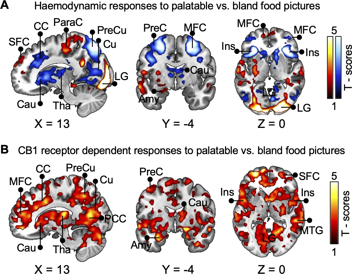 Brain scan comparing responses to palatable vs. bland food pictures across sagittal (X=13), coronal (Y=-4), and axial (Z=0) slices. Panel A shows hemodynamic responses labeled at regions including CC, ParaC, PreCu, Cu, SFC, LG, Cau, Tha, MFC, Ins, and Amy. Panel B shows CB1 receptor-dependent responses at similar regions plus PCC and MTG.