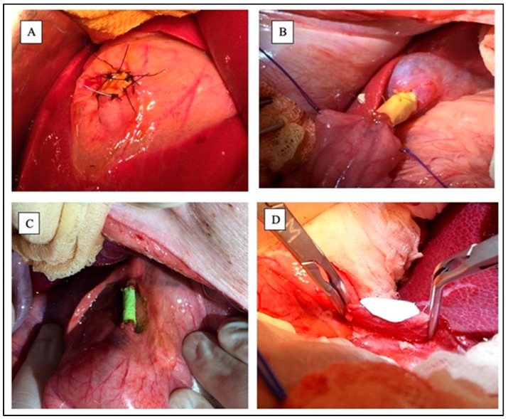 Experimental groups during surgeries. (A) Gallbladder wall planar scaffold; (B) Gallbladder-jejunal scaffold; (C) Common Bile Duct tubular scaffold; (D) Common Bile Duct patch during suturing. Sources: (A–C) are reprinted from Ref. [38]; (D) = owned by the co-authors.
