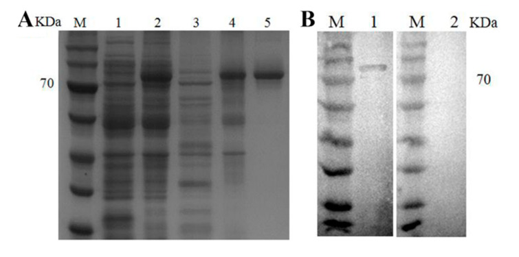 Preparation of polyclonal antibody. (A) Recombinant expression of PvKelch-like-1. Lane M, protein marker; Lane 1, control group with no isopropyl β-D-thiogalactopy ranoside (IPTG); Lane 2, control group inducted for 2 h with 1.0 mM IPTG; Lane 3, the sample of supernatant; Lane 4, dissolution of precipitation; Lane 5, purified protein; (B) Western blot analysis of the polyclonal antibody. Lane M, protein marker; Lane 1, PvKelch-like-1 recombinant protein incubated with experimental group serum; Lane 2, PvKelch-like-1 recombinant protein incubated with control group serum.