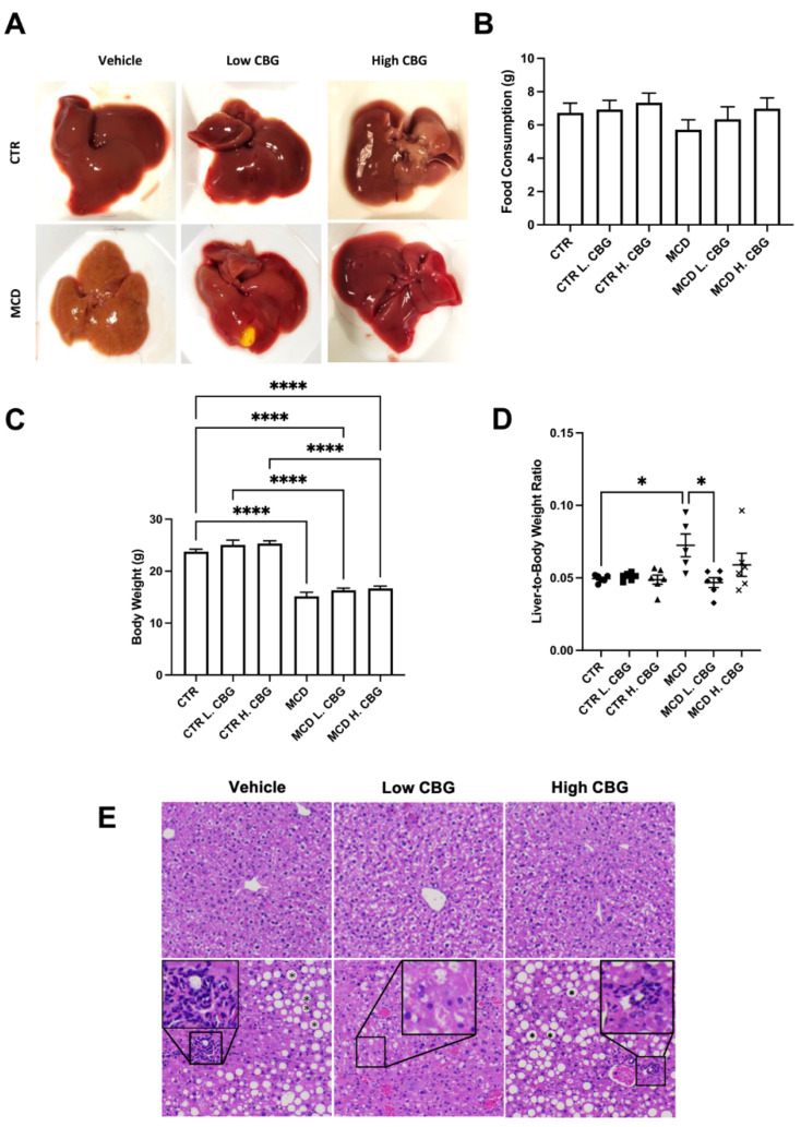 Evaluation of the overall liver health with the induction of NASH using MCD diet and role of CBG in reducing the liver damage. Representative images of liver post-harvest to illustrate the differences in morphologies between groups (A) Average total food consumption (B), Body Weight (C) and average liver weight-to-body weight ratio (D) was calculated among groups. Representation of the liver after being stained with H&E (E), showing lipid accumulation (mark as asterisk in hepatic ballooning area) and white blood cells infiltration (enlarged area) with the MCD diet (bottom row). * p < 0.05, **** p < 0.0001.