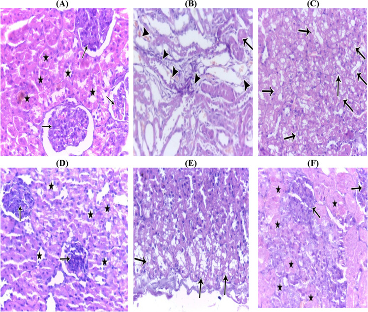 A Photomicrograph of control healthy renal tissue of a rat showing normal glomeruli (arrow) and tubules (star) (H&E, × 400). B Photomicrograph of renal tissue of a rat under effect of doxorubicin showing trophic glomeruli (arrow) with aggregates of inflammatory cells and areas of hemorrhage (arrowhead) (H&E, × 400). C Photomicrograph of renal tissue of a rat under effect of doxorubicin showing severe hydropic degeneration (arrow) of the renal tubules (H&E, × 400). D Photomicrograph of renal tissue of a rat under the effect of CBD showing normal renal glomeruli (arrow) and tubules (star) (H&E, × 400). E Photomicrograph of renal tissue of a rat under the effect doxorubicin and treated with CBD showing mild hydropic degeneration of the renal tubules (arrow) (H&E, × 400). F Photomicrograph of renal tissue of a rat under the effect doxorubicin and treated with TMZ showing marked improvement and nearly normal glomeruli (arrow) and tubules hydropic degeneration of the renal tubules (star) (H&E, × 400)