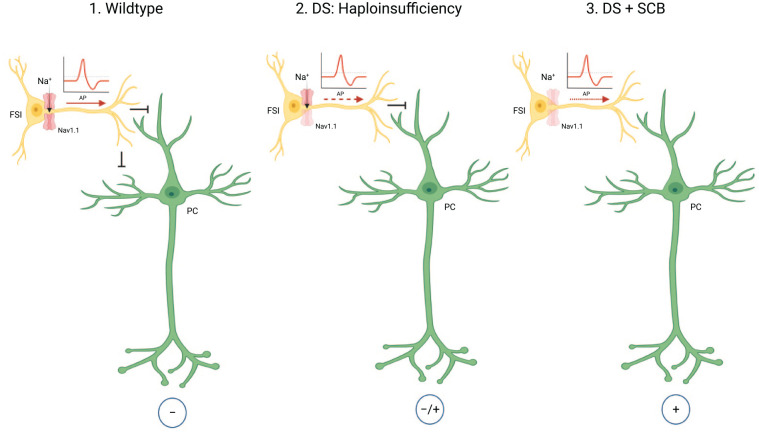 Interneuron model in Dravet syndrome (DS). Nav1.1 is mainly expressed on axon hillocks of fast-spiking inhibitory interneurons, and heterozygous SCN1A mutations will most likely lead to a loss of excitability of GABAergic inhibitory interneurons, resulting in hyperexcitability of downstream pyramidal neurons. Sodium channel blocker (SCB) can cause further seizure deterioration in DS patients due to the inhibition of the remaining functionally intact channels (de Lange and others 2018; Oakley and others 2011; Yu and others 2006). AP = action potential; FSI = fast-spiking GABAergic interneuron; PC = pyramidal cell. Adapted from Jensen and others (2014). Figures were created using BioRender©.