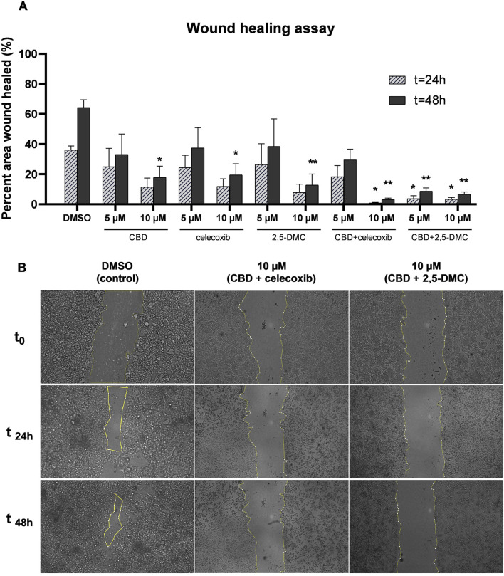 Graph A shows a bar chart illustrating the percent area of a wound healed after 24 and 48 hours under different treatments: DMSO, CBD, celecoxib, 2,5-DMC, and their combinations. Higher healing is observed at 48 hours, particularly with DMSO and 10 µM concentrations. Graph B displays microscopic images of wound healing at time points 0, 24, and 48 hours for DMSO, 10 µM CBD with celecoxib, and 10 µM CBD with 2,5-DMC, showing progressive wound closure over time.