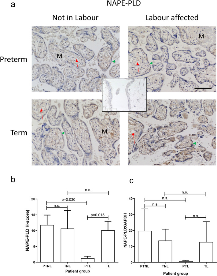 Effect of labour and prematurity on NAPE-PLD protein and transcript expression and levels. Representative photomicrographs of villous trophoblasts from ten images taken for each patient within each of the four patient groups (n = 6 samples per group) are shown in panel a. Images were obtained at 200× and 40× magnification as described in the legend to Fig. 2. Bar, 50 μm. Panel b shows the results of histomorphometric analyses of the 240 NAPE-PLD immunoreactivity images for the four different patient groups. Differences between groups were calculated using one-way ANOVA; n.s. non-significant. Panel c shows the levels of NAPE-PLD mRNA corrected for the levels of GAPDH. Data are presented as the mean ± SEM of six patient samples in each group, with each sample examined in triplicate. Differences in expression levels were determined using one-way ANOVA with Dunnett’s T3 multiple comparisons tests; p-values are shown for significant comparisons