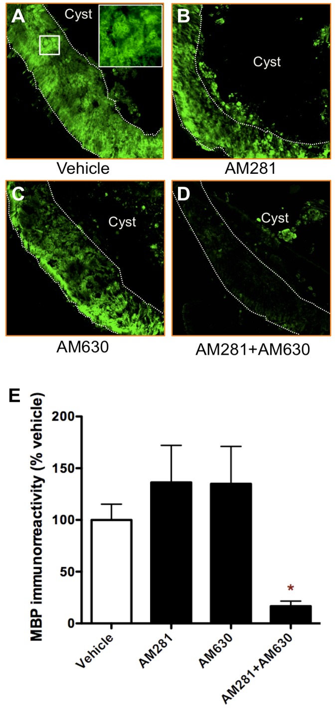 Early blockade of CB1 and CB2 receptors results in less MBP immunoreactivity 90 days after lesion.(A-D) Representative images of MBP immunostaining at lesion epicentre of vehicle-, AM281-, AM630- and 281/AM630- treated rats. (E) Densitometry of MBP immunoreactivity at the epicentre shows that MBP levels are lower in AM281/AM630-treated rats compared to vehicle-treated animals. *p<0.05 vs. vehicle-treated rats. Vehicle n = 10; AM281 n = 6; AM630 n = 5; AM281+AM630 n = 10.