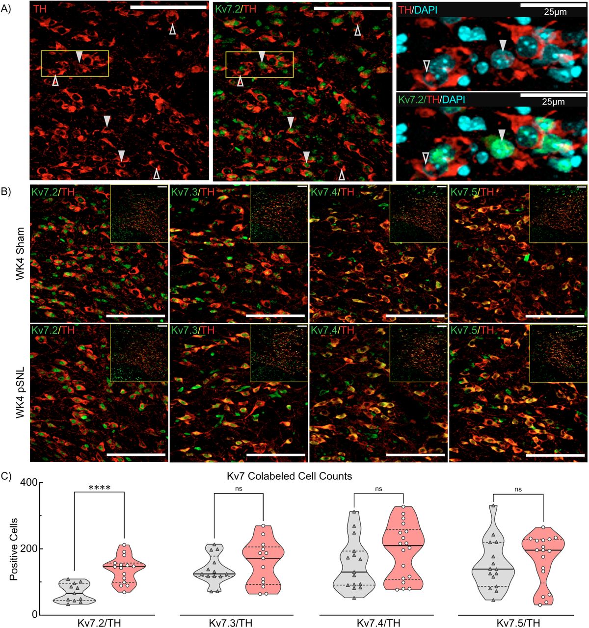 Elevated Kv7.2 Expression in TH+ VTA Dopamine Cells at WK4 pSNL.a Confocal photomicrographs of the contralateral VTA region from a male mouse at four weeks control sham-surgery, showing varying magnifications. Immunostaining reveals TH (red), Kv7.2 (green), and DAPI staining presented in single-channel images and overlays. Co-expression (TH+/Kv7.2+,▾) differentiates between cells expressing both markers versus those expressing only one. Scale bars: 100 μm; 25um. b Similar photomicrographs from WK4 male mice divided into sham-operated (top panels) and pSNL (bottom panels) groups, depicting co-localization of TH (red) with Kv7.2-5 (green). Images underwent rolling-ball background subtraction, linear contrast adjustment, and resizing for display. Scale bars: 100 µm. c Violin plots quantifying co-labeled VTA TH+ and Kv7.2-5+ cells. Increased Kv7.2 expression in pSNL mice compared to sham-operated controls was significant (t(24)=4.868. ****p<0.0001). No significant differences were detected for Kv7.3 (t(24)=0.8747 p=0.3904), Kv7.4 (t(31)=1.426 p=0.1638), or Kv7.5 expression (t(30)=0.5523, p=0.5849).