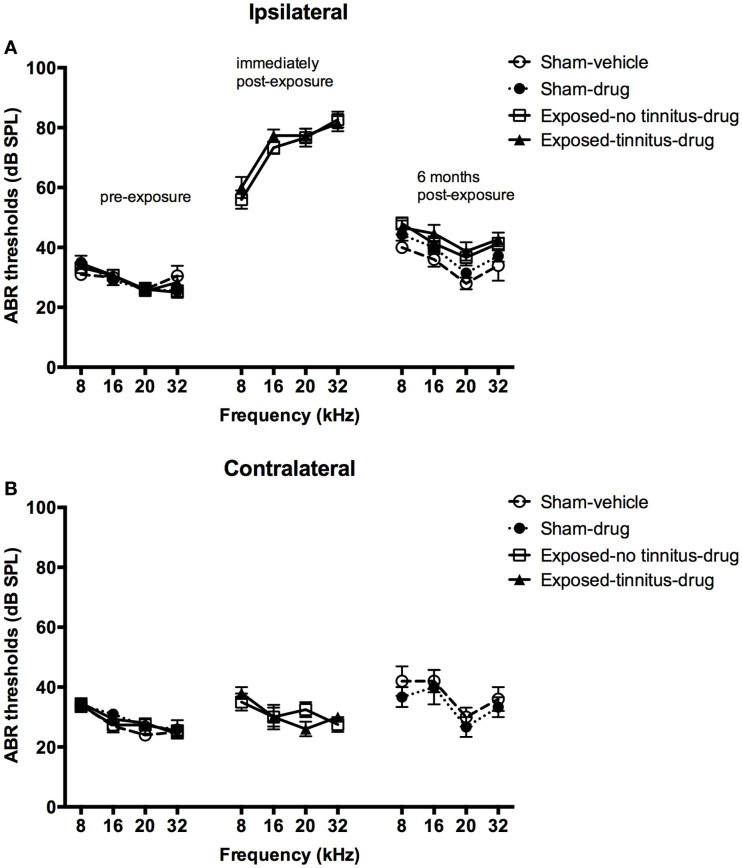 ABR thresholds for the ipsilateral (A) and contralateral (B) ears of sham-vehicle, sham-acoustic, exposed-no tinnitus-drug, and exposed-tinnitus-drug animals pre-exposure, immediately post-exposure, and 6 months post-exposure, as a function of stimulus intensity in dB SPL and frequency in kHz. Data are presented as means ± 1 SE.