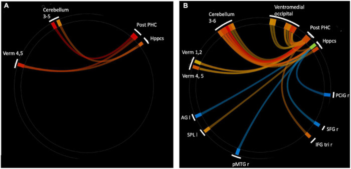 ROI-to-ROI analysis using hippocampal and parahippocampal cortex (anterior and posterior) seeds. (A) Significantly strengthened connections for aged users vs. aged non-users. There were no connections that were significantly stronger for aged non-users vs. users. (B) Significantly altered connections for younger (18–35 years) vs. older (60+ years) non-users. Warm colors indicate young > old, cool colors indicate old > young. Ventromedial occipital includes occipital fusiform, temporal occipital fusiform, and posterior temporal occipital fusiform. Abbreviations: r, right; I, left; Verm, vermis; Post-PHC, posterior parahioppocampal cortex; Hppcs, hippocampus; PCiG, paracingulate gyrus; SFG, superior frontal gyrus; IFG tri, interior frontal gyrus, pas triangularis; pMTG, middle temporal gyrus, posterior division; SPL, superior parietal lobule; AG, angular gyrus.