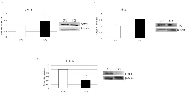 Iron metabolism in OCs derived from CCS.Protein expression of DMT1 (A), Transferrin Receptor 1, TfR1(B), Ferroportin, FPN1 (C) in OCs from 5 Childhood cancer survivors (CCS) compared with OCs from 5 healthy subjects (CTR), determined by Western Blot starting from 15μg of total lysate. The most representative images are showed. The Image Studio Digits software has been used for the protein bands density detection. The intensity ratios of immunoblots compared to CTR, considered as 1, were quantified after normalization with the housekeeping protein β-Actin. Histogram show the relative quantification for DMT1, TfR1 and FPN-1 as mean ± SD of independent experiments on each individual sample. For statistical analysis it has been used a t-test. *Indicates p ≤ 0.05 compared to CTR.
