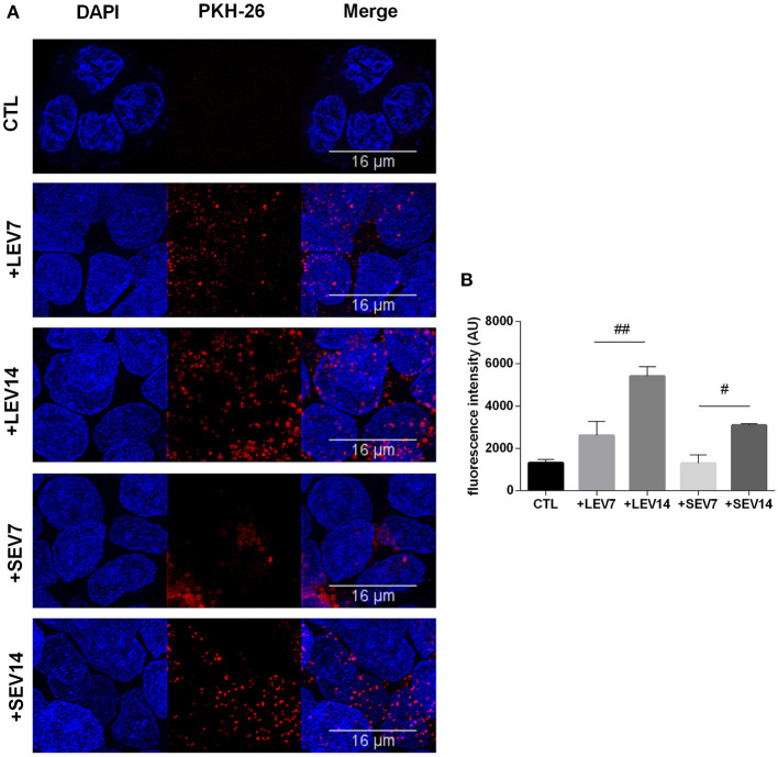 The two G. intestinalis EV sub-populations are efficiently taken up by Caco-2 cells. (A) Caco-2 cells incubated with PKH26-labeled LEVs or SEVs. (B) Internalized EVs were quantified by means of fluorescence intensity. Background signal was subtracted for every single image before obtaining the fluorescence intensity (Arbitrary Units); scale bars are indicated at 16 μm. Data are representative of at least three independent experiments and represented as means ± SEM. #P = 0.05, ##P = 0.01; vs. the corresponding group, indicated by line.