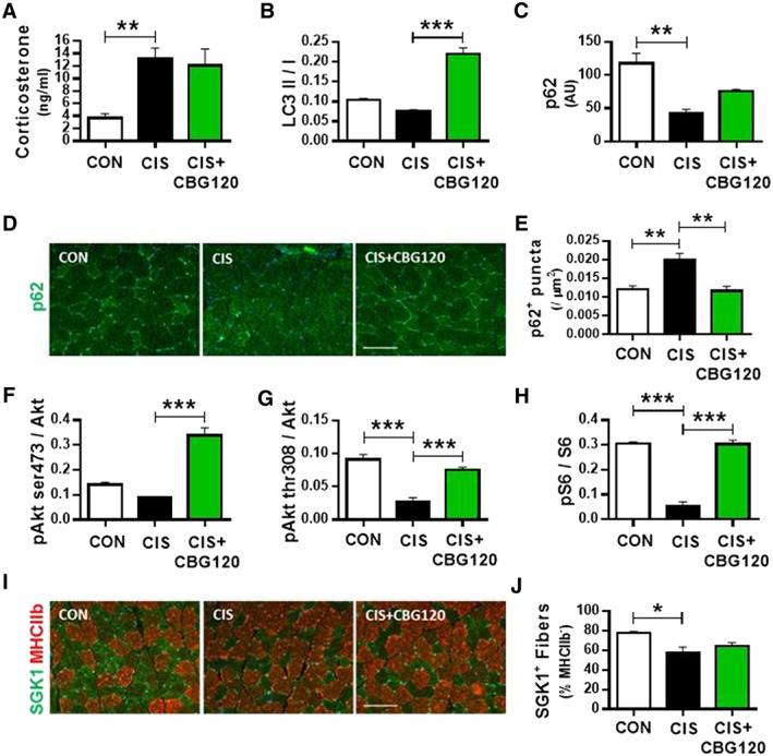 Cannabigerol rescues cisplatin‐induced dysregulation of myofibre autophagy and protein synthesis. Plasma corticosterone levels determined by ELISA (A; n = 6–9); EDL muscle tissue Western blot analysis of autophagy markers LC3 (B) and p62 (C) and immunohistochemical quantification of p62 (D, E; scale bars = 100 μm); expression of protein synthesis markers pAkt ser473 (F), pAkt thr308 (G) and pS6 (H) and immunohistochemical quantification of protein synthesis marker SGK1 (I, J; scale bars = 100 μm; all n = 3). Data presented as mean ± SEM and analysed by one‐way between‐subjects ANOVA and planned comparisons. * P < 0.05, ** P < 0.01, *** P < 0.0005.