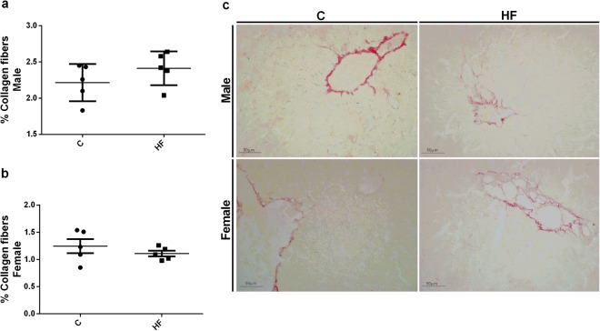 Effect of maternal HF diet on percentage of collagen fibers in liver in both male (a) and female (b) offspring at 180-day-old. Representative images are shown (c). Data is expressed as mean ± S.E.M, n = 5 per group; *p < 0.05, by Student’s t test.