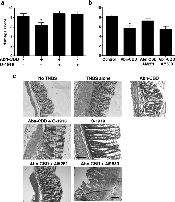 The effects of Abn-CBD treatment on microscopic damage score and histology. TNBS-treated mice were given O-1918, AM251, AM630 (all at 5 mg/kg) and/or Abn-CBD (5 mg/kg) twice daily for 3 days. Microscopic damage score (a and b) and histological appearance of the hematoxylin/eosin stained tissue (c) were determined at the end of the experiment, 24 h after the last dose of drug. TNBS-treated mice displayed severe mucosal damage as well as an increase in lymphocyte and neutrophil infiltration. a Mucosal damage was significantly reduced by Abn-CBD treatment and reversed by addition of O-1918; *, p < 0.05, when compared to any other treatment group. b Mucosal damage was significantly reduced by Abn-CBD treatment and partly reversed by administration of AM251; *, p < 0.05, when compared to TNBS alone. Data were analyzed with one-way ANOVA with Tukey’s post-hoc test, n = 4-5/group. Scale bar in C. = 100 μm