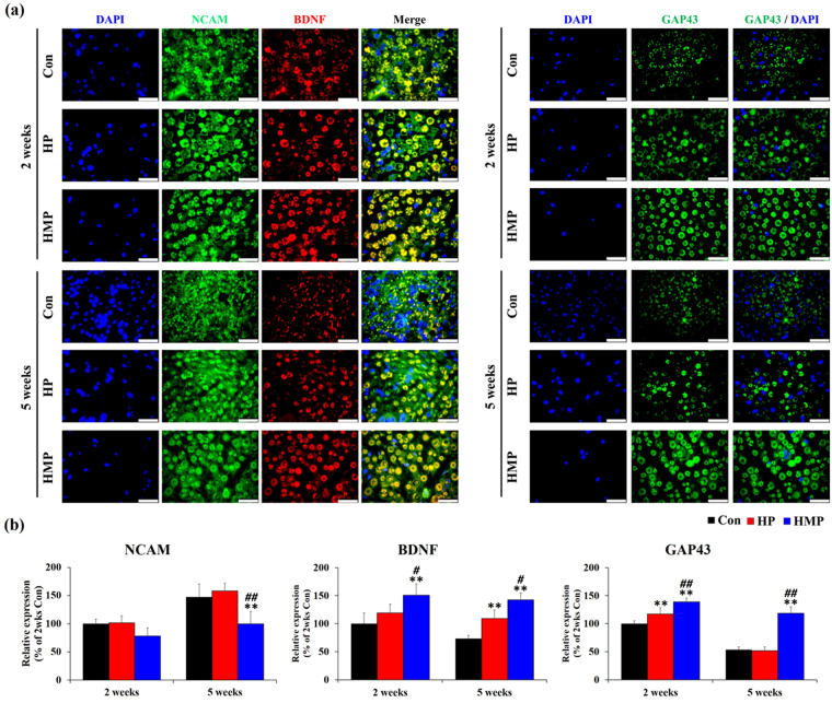 Immunofluorescence staining for NCAM, BDNF, and GAP43 in the sciatic nerves at 2 and 5 weeks post-implantation. (a) Immunofluorescence with antibodies to NCAM, GAP43 (green) and BDNF (red). Scale bar = 25 μm (b) Statistical analysis of immunofluorescence staining (n = 3 per each group and each time point). Results are expressed as mean ± SD. *Compared to Con, #Compared to HP, *, # p < 0.05, **, ## p < 0.01; One-Way ANOVA analysis.