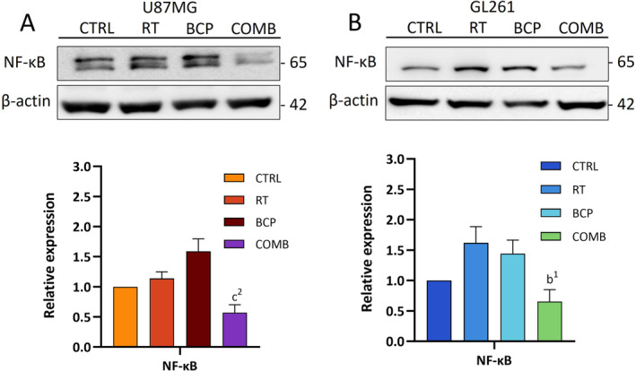BCP combined with RT decreased NF‐κB expression in GBM cells. Representative images and quantification results of NF‐κB in (A) U87MG and (B) GL261 cells after different treatments. “b” compares to RT and “c” compares to BCP. Statistical significance:1, p < 0.05; 2, p < 0.01. Error bars indicate SEM and the range of three biological replicates. One‐way ANOVA was used for the analysis.