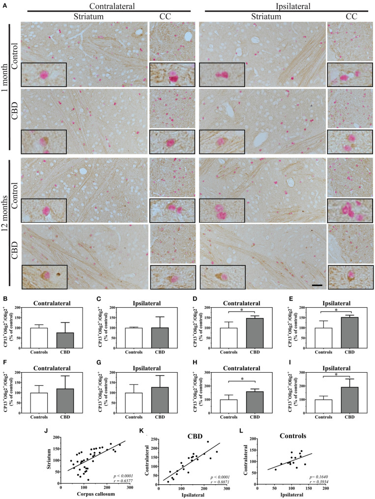 The tau pathology transmission in oligodendrocytes. (A) The microphotography pictures of double immunohistochemistry staining of tau phosphorylated at Ser202 (CP13 antibody, brown chromogen) in oligodendrocytes (Olig2, nuclear marker, red/pink chromogen). The cell distribution in the contralateral (left panel) and ipsilateral side (right panel) of the striatum (left subpanel) and corpus callosum (right subpanel) after 1 month (upper panel) and 12 months (lower panel) of control-tau (upper subpanel) or CBD-tau (lower subpanel) inoculation. The representative pictures of cells in each group are presented as the black bordered inserts. The presence of pathological tau in oligodendrocytes increases upon CBD-tau inoculation at 12 months postsurgery. No changes for control-tau were observed. The scale bar represents 50 μm and applies to all pictures; the black-bordered inserts represent 4× digital enlargement. (B–I) the quantitative analysis of double positive oligodendrocytes (CP13+/Olig2+): 1 month postsurgery in the contralateral (B, controls n = 3, CBD n = 8) and ipsilateral (C, controls n = 4, CBD n = 8) striatum; 12 month postsurgery in the contralateral (D, controls n = 6, CBD n = 4) and ipsilateral (E, controls n = 4, CBD n = 4) striatum; 11 months postsurgery in the contralateral (F, controls n = 3, CBD n = 7) and ipsilateral (G, controls n = 4, CBD n = 7) corpus callosum; and 12 month postsurgery in the contralateral (H, controls n = 5, CBD n = 4) and ipsilateral (I, controls n = 4, CBD n = 4) corpus callosum. The significant increase of tau phosphorylated at Ser202 positive oligodendrocytes in CBD-tau injected animals was observed in striatum and corpus callosum 12 months postsurgery compared to control-tau animals. (J–L) the correlation of double-positive oligodendrocytes (CP13+/Olig2+) as a fraction of all oligodendrocytes between the corpus callosum and striatum (J), between the ips- and contralateral side of CBD-tau (K) and control-tau (L) injected animals. The striatum and corpus callosum transmissible changes in oligodendrcytic tau pathology were detected by the presence of the significant positive correlation between them (J). The significant positive correlation between ipsi-and contralateral hemispheres of oligodendrcytic tau pathology was observed only in CBD-tau (K), and not control-tau (L) injected animals strengthening that only pathological tau is able to trigger transmissible changes in oligodendrocytes across hemispheres. Comparison between 2 groups was performed using the Mann–Whitney U test. Spearman's rank correlation coefficient was used to analyze dependence between 2 sets of data. P value < 0.05 was considered statistically significant. *P < 0.05.